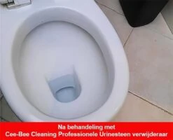 Urinesteen Pakket - Voor Het Verwijderen Van Urinesteen En Het Voorkomen Van Urinesteen - 1x Urinesteenoplosser - 2x Toiletreiniger -Huishoudelijke Schoonmaak 1200x971 7